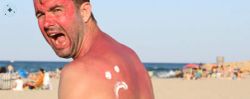 T'has cremat amb el sol? Guia completa per tractar una cremada solar i tenir cura de la pell aquest estiu