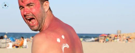 T'has cremat amb el sol? Guia completa per tractar una cremada solar i tenir cura de la pell aquest estiu