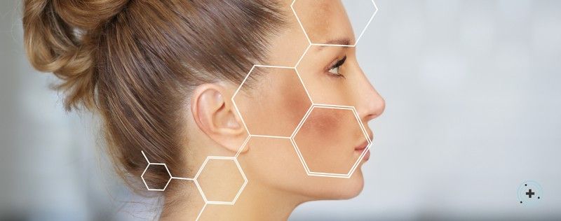 Despigmentantes y Cuidado Facial: Redefine Tu Rutina para Eliminar Manchas Faciales